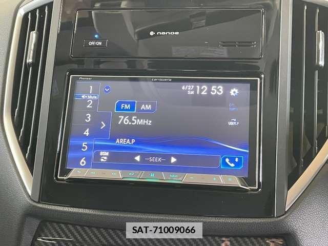 Subaru XV 2017-06 7818284-2