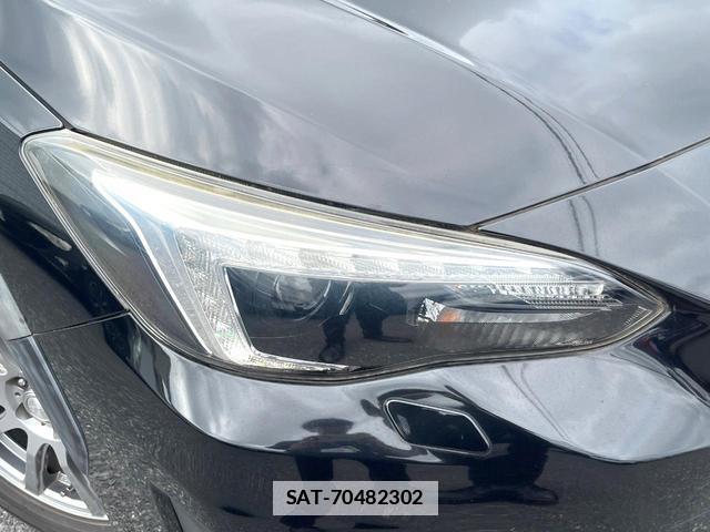 Subaru XV 2017-06 7935319-11