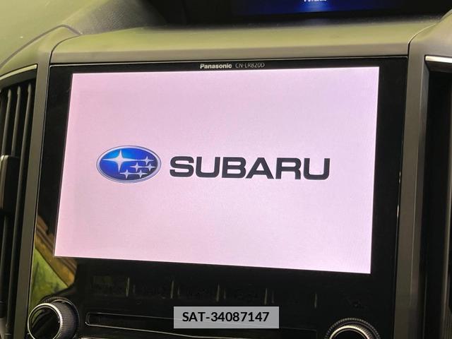 Subaru XV 2017-09 7959356-2
