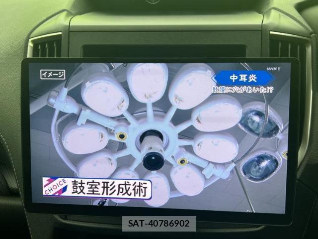 Subaru FORESTER 2022-03 8225175-9